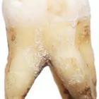 A tooth