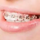 A person with braces on their teeth